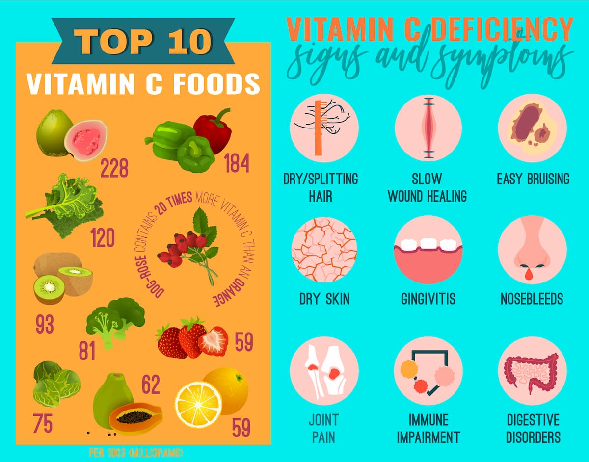 Vitamin C deficiency infographic