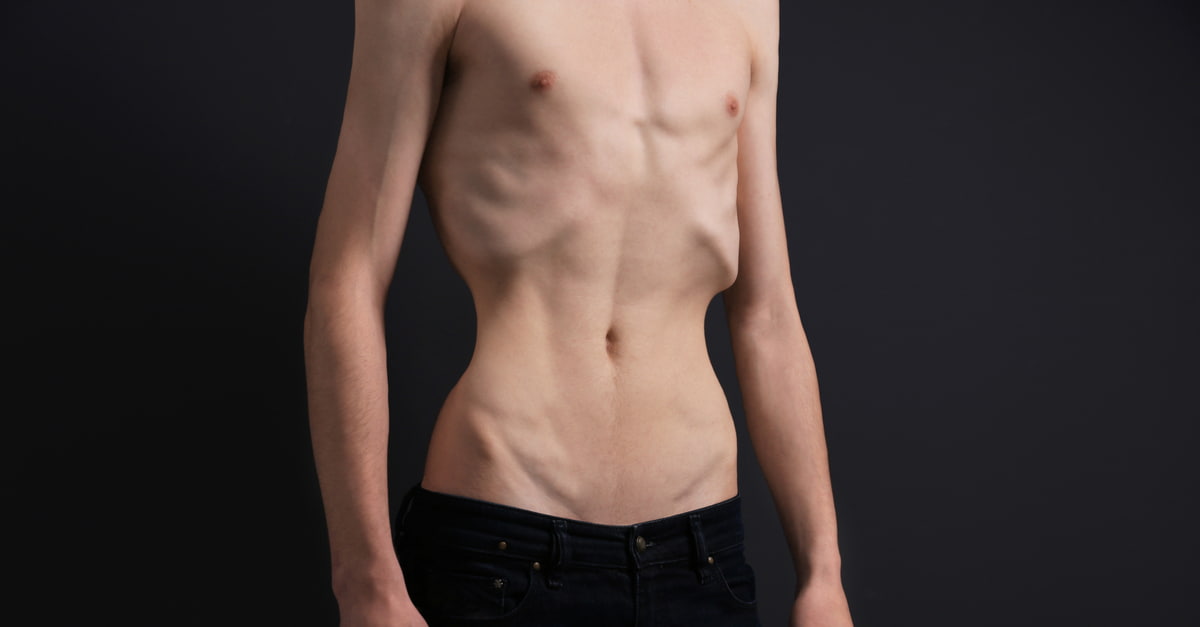 Young man with anorexia on dark background