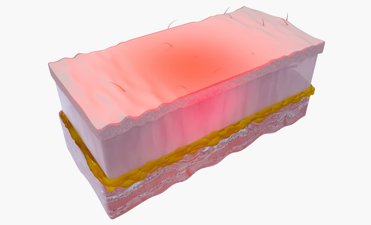 3D illustration - Red light skin therapy that uses red low-level wavelengths of light to treat skin issues.