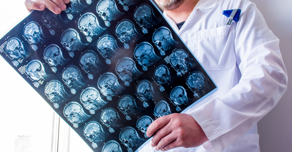 Doctor examines MRI scan of head, neck and brain of patient, holding in hands. 